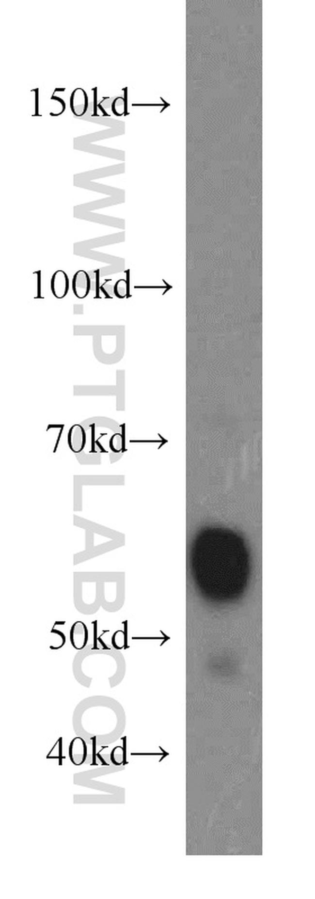 ARIH2 Antibody in Western Blot (WB)