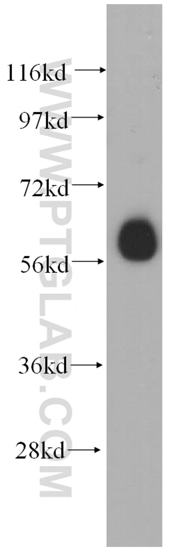 ARIH2 Antibody in Western Blot (WB)