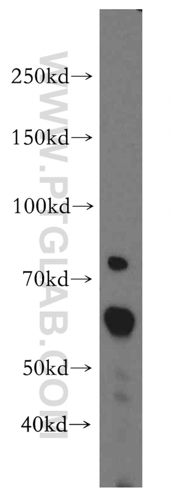 ARIH2 Antibody in Western Blot (WB)