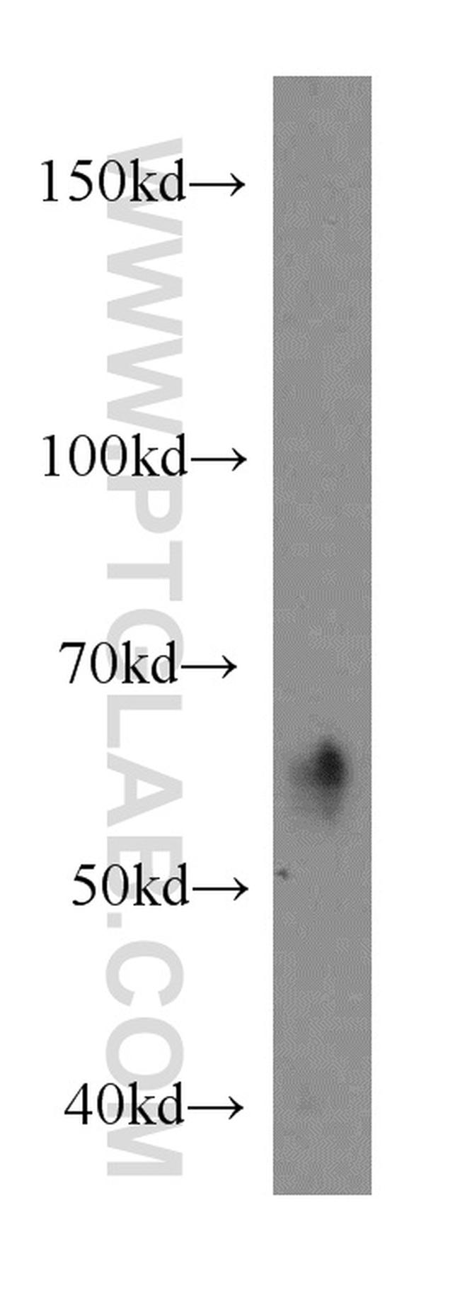 ARIH2 Antibody in Western Blot (WB)