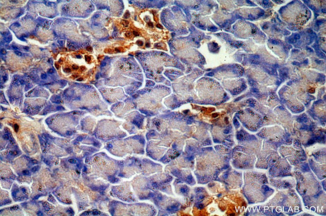 ENC1 Antibody in Immunohistochemistry (Paraffin) (IHC (P))