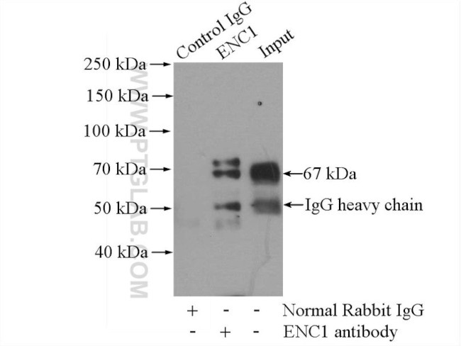 ENC1 Antibody in Immunoprecipitation (IP)