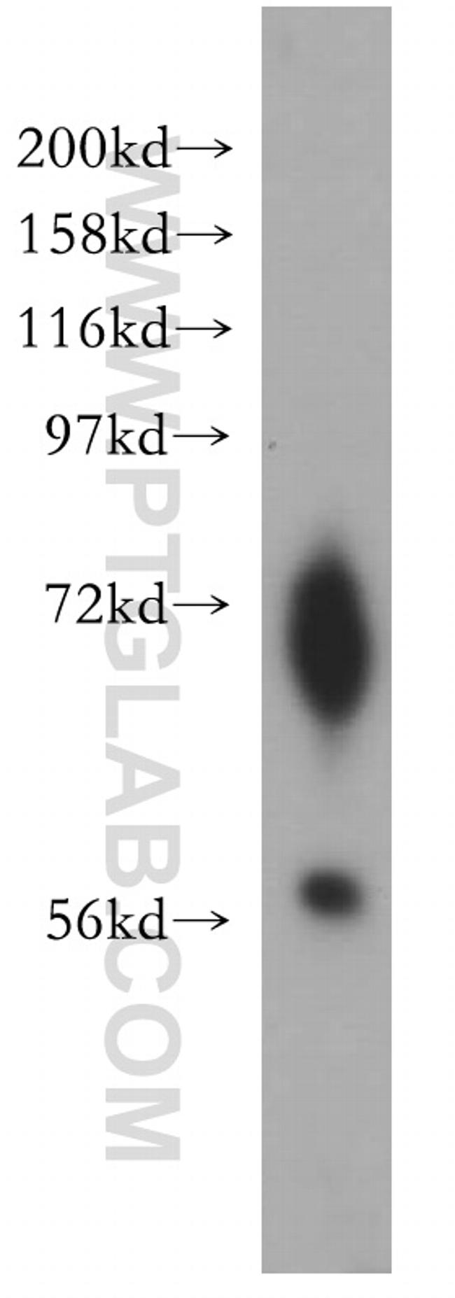 ENC1 Antibody in Western Blot (WB)