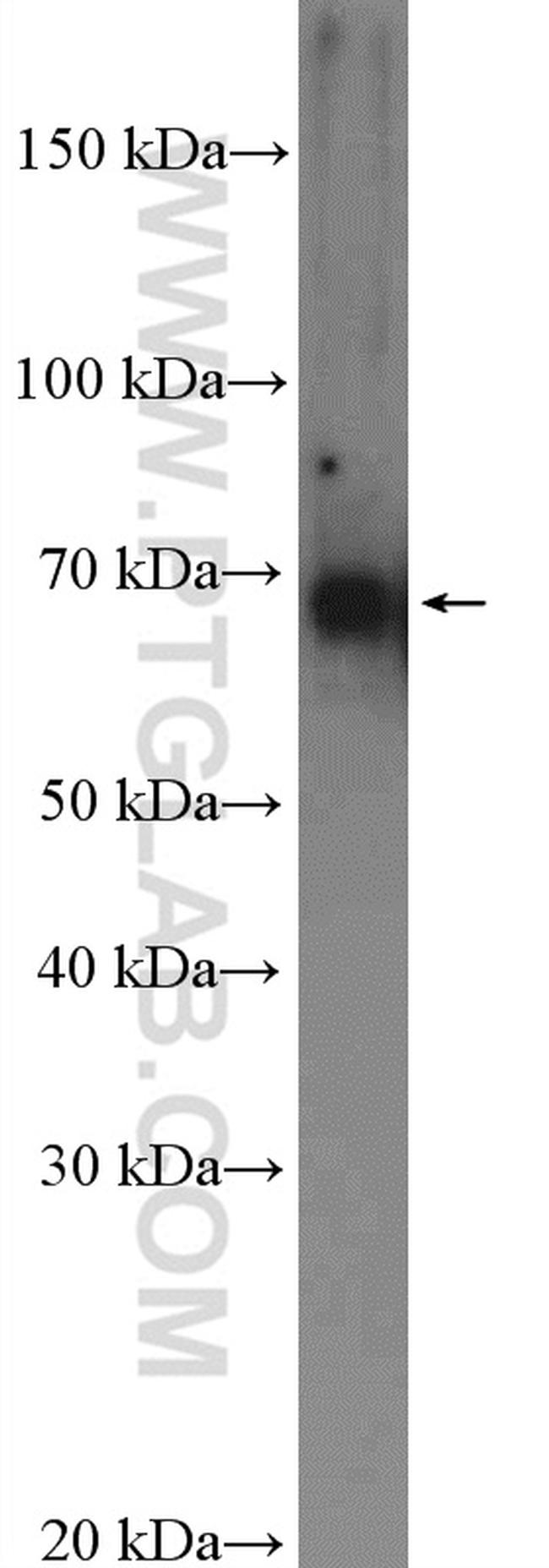 ENC1 Antibody in Western Blot (WB)