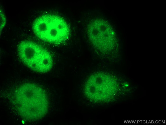 SKP2 Antibody in Immunocytochemistry (ICC/IF)