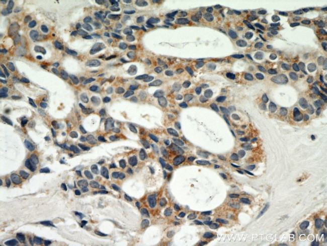 SKP2 Antibody in Immunohistochemistry (Paraffin) (IHC (P))