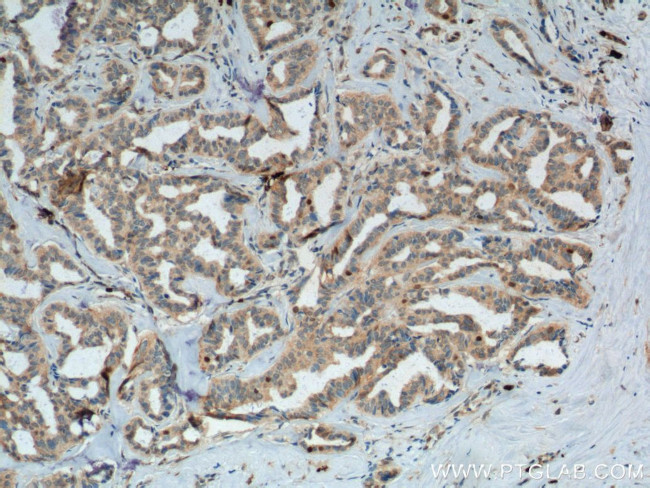 SKP2 Antibody in Immunohistochemistry (Paraffin) (IHC (P))