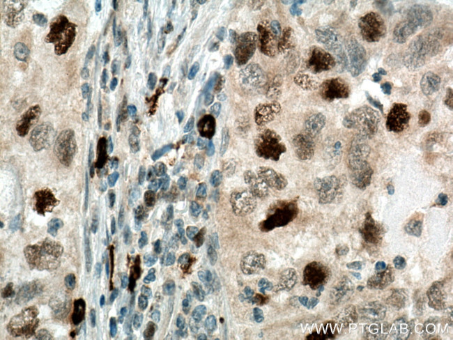 SKP2 Antibody in Immunohistochemistry (Paraffin) (IHC (P))