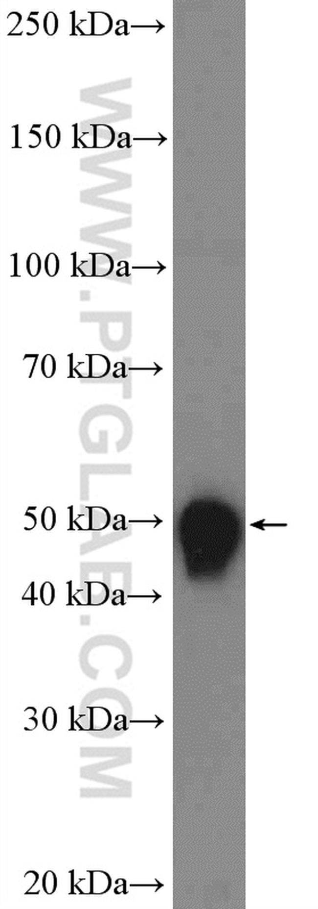 SKP2 Antibody in Western Blot (WB)