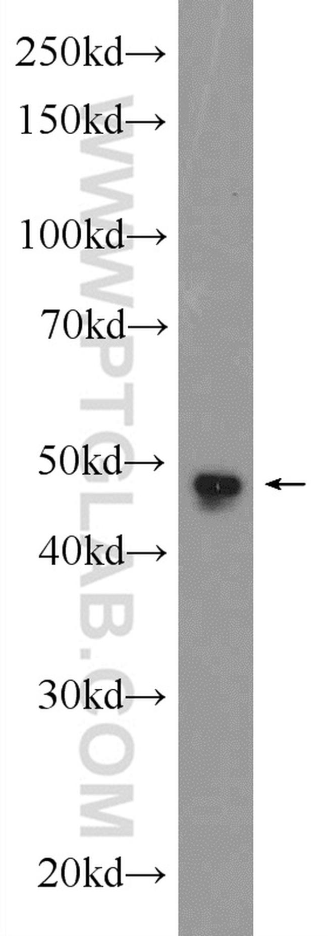 SKP2 Antibody in Western Blot (WB)