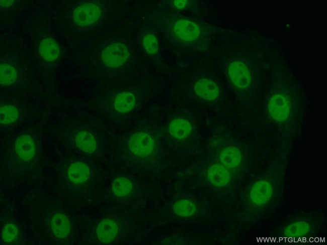 CITED2 Antibody in Immunocytochemistry (ICC/IF)