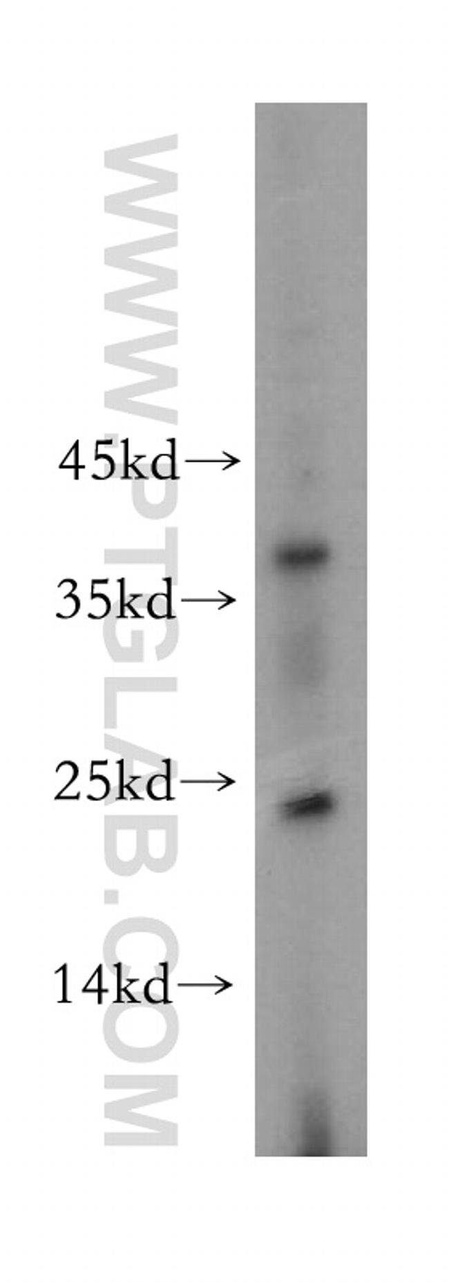 CITED2 Antibody in Western Blot (WB)