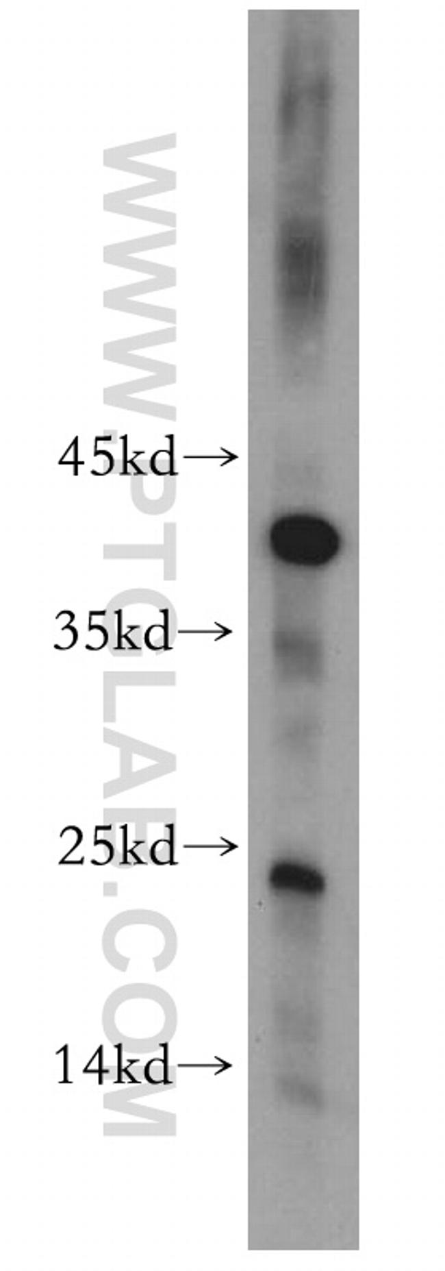 CITED2 Antibody in Western Blot (WB)