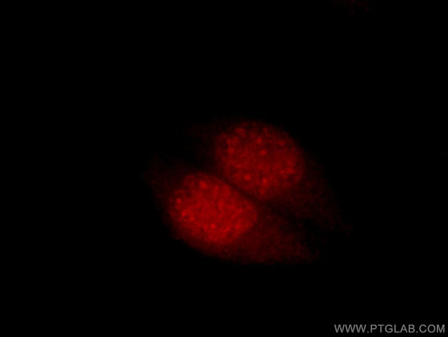 CPSF4 Antibody in Immunocytochemistry (ICC/IF)