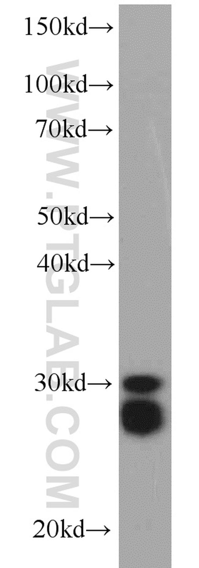 CPSF4 Antibody in Western Blot (WB)