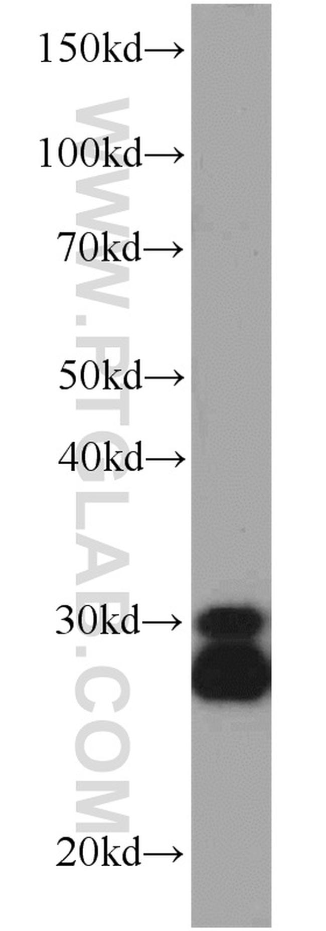 CPSF4 Antibody in Western Blot (WB)