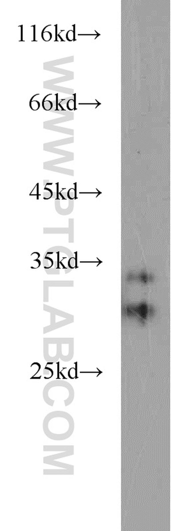 CPSF4 Antibody in Western Blot (WB)