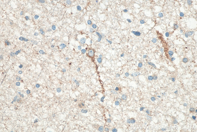 RAB3A Antibody in Immunohistochemistry (Paraffin) (IHC (P))