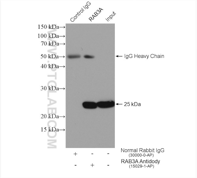 RAB3A Antibody in Immunoprecipitation (IP)