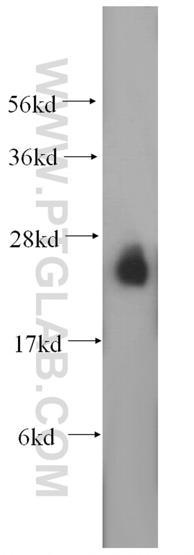 RAB3A Antibody in Western Blot (WB)