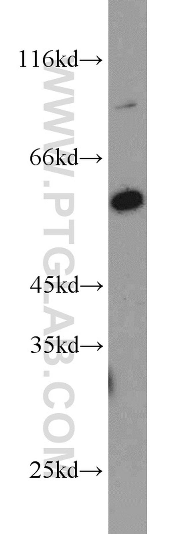 PHF17 Antibody in Western Blot (WB)