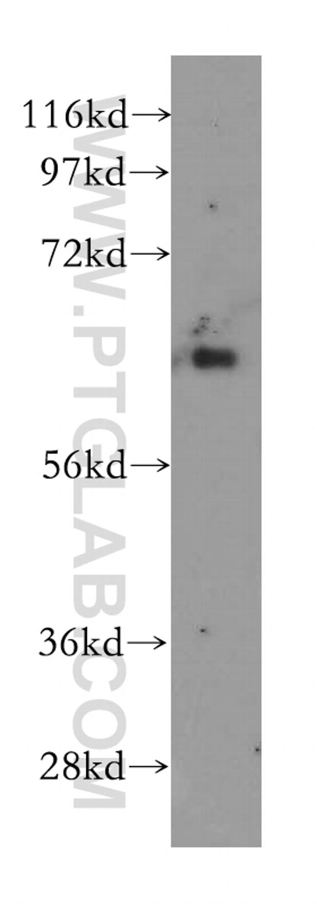 PHF17 Antibody in Western Blot (WB)