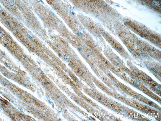 OSGEP Antibody in Immunohistochemistry (Paraffin) (IHC (P))