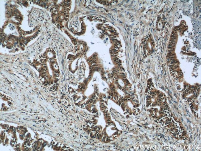 OSGEP Antibody in Immunohistochemistry (Paraffin) (IHC (P))