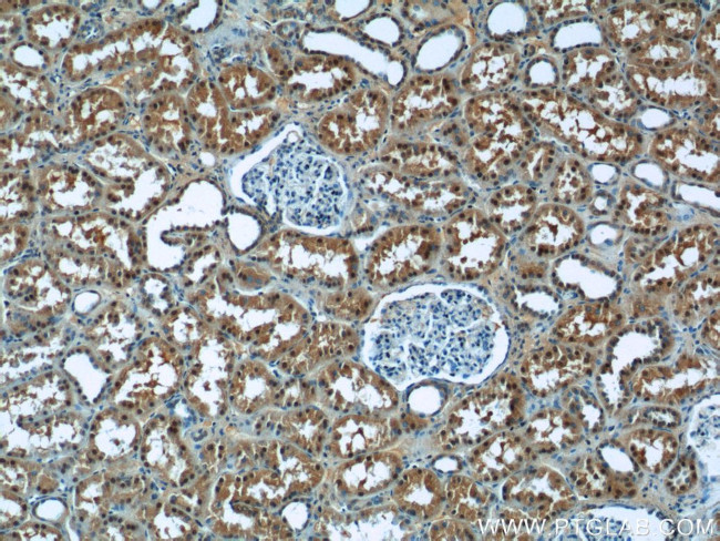 OSGEP Antibody in Immunohistochemistry (Paraffin) (IHC (P))