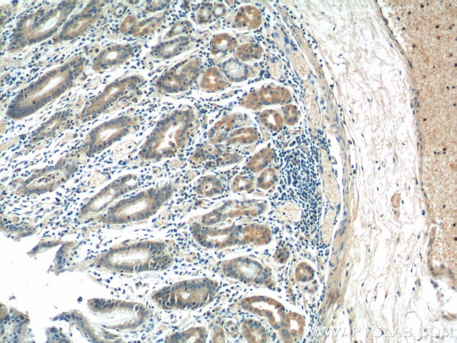 AZI2/NAP1 Antibody in Immunohistochemistry (Paraffin) (IHC (P))