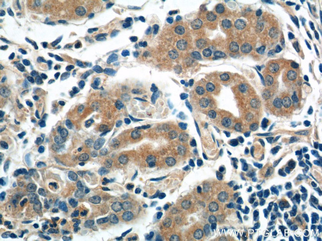 AZI2/NAP1 Antibody in Immunohistochemistry (Paraffin) (IHC (P))