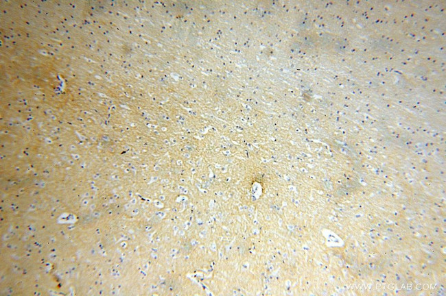 GPM6A Antibody in Immunohistochemistry (Paraffin) (IHC (P))