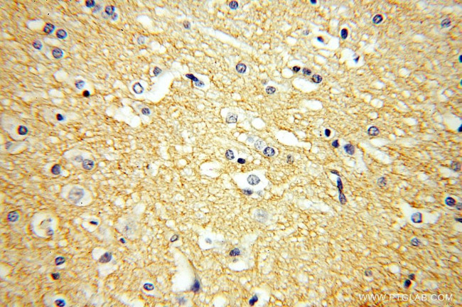 GPM6A Antibody in Immunohistochemistry (Paraffin) (IHC (P))