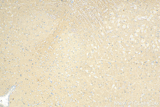 GPM6A Antibody in Immunohistochemistry (Paraffin) (IHC (P))