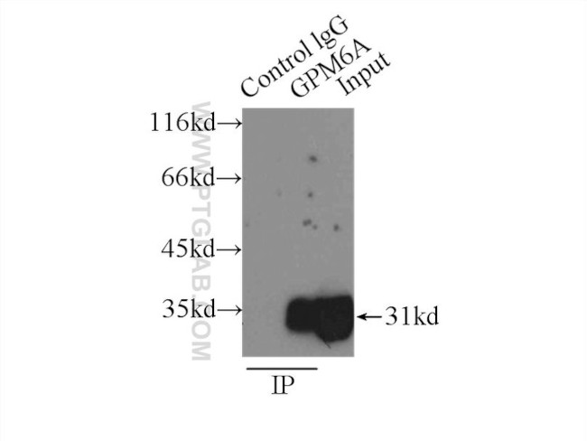 GPM6A Antibody in Immunoprecipitation (IP)