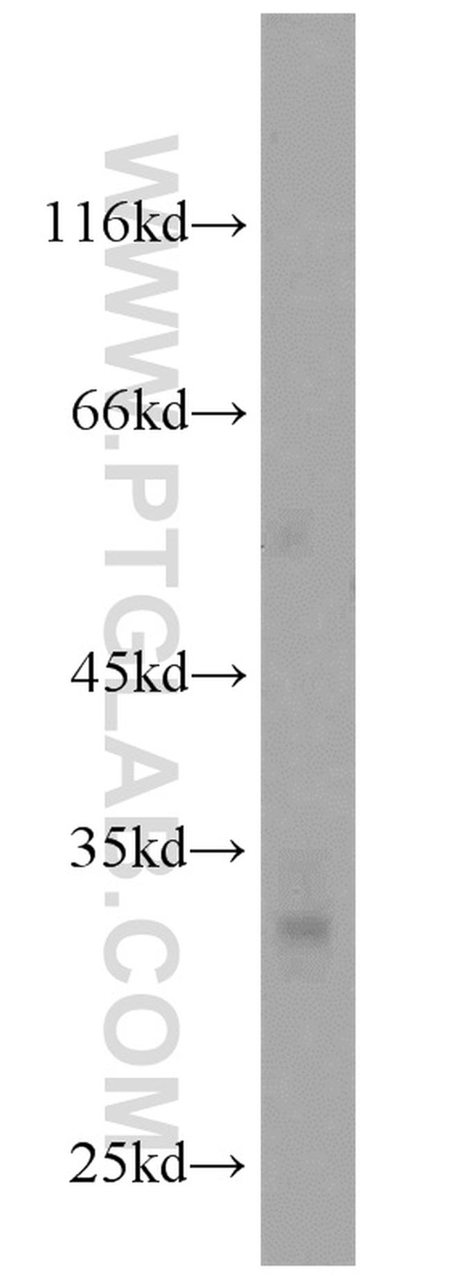 GPM6A Antibody in Western Blot (WB)