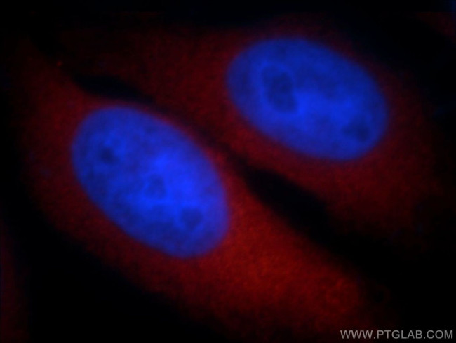 POMP Antibody in Immunocytochemistry (ICC/IF)