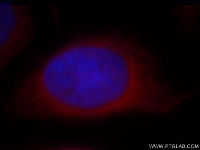 POMP Antibody in Immunocytochemistry (ICC/IF)