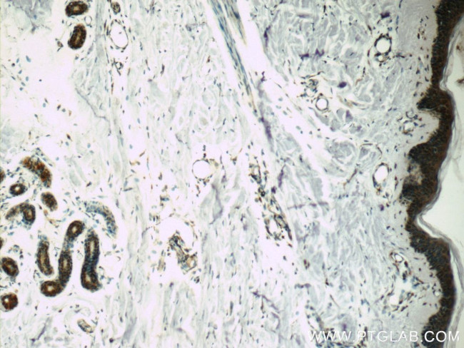 POMP Antibody in Immunohistochemistry (Paraffin) (IHC (P))