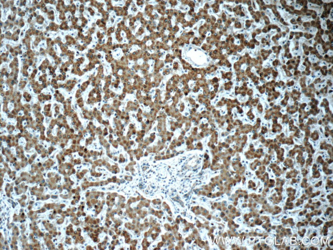 POMP Antibody in Immunohistochemistry (Paraffin) (IHC (P))