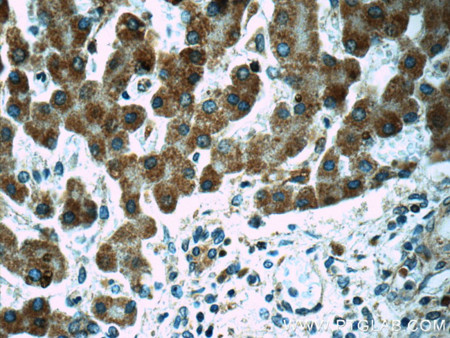 POMP Antibody in Immunohistochemistry (Paraffin) (IHC (P))