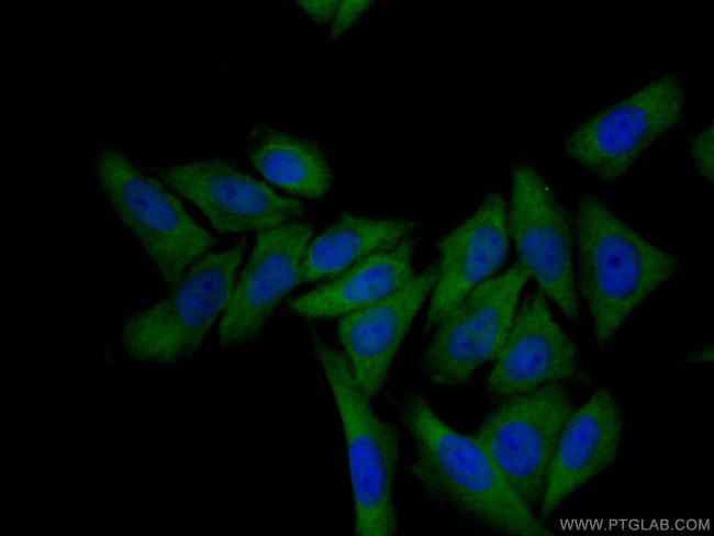 Thymidylate synthase Antibody in Immunocytochemistry (ICC/IF)