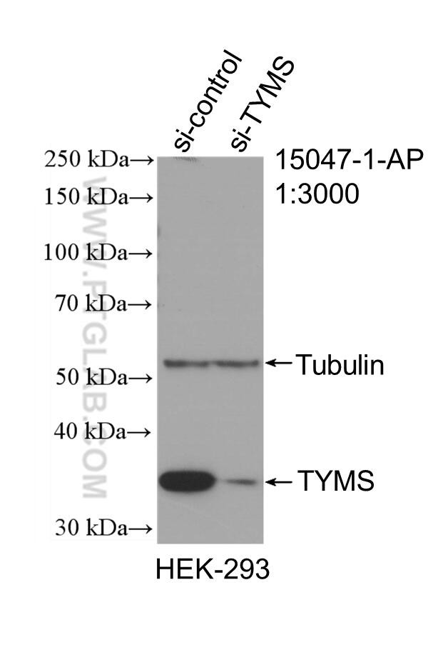 Thymidylate synthase Antibody in Western Blot (WB)