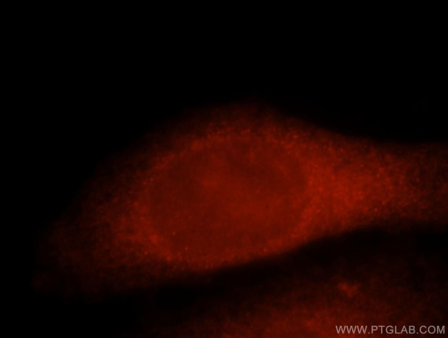 Thymidylate synthase Antibody in Immunocytochemistry (ICC/IF)