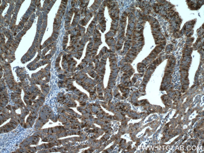 Thymidylate synthase Antibody in Immunohistochemistry (Paraffin) (IHC (P))