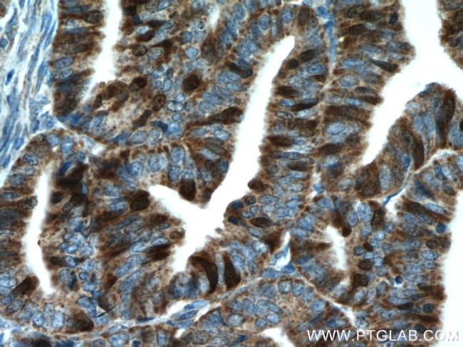 Thymidylate synthase Antibody in Immunohistochemistry (Paraffin) (IHC (P))