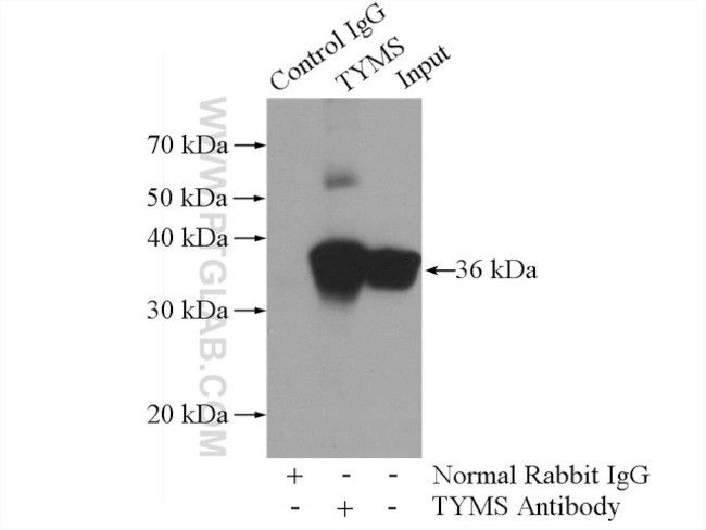 Thymidylate synthase Antibody in Immunoprecipitation (IP)