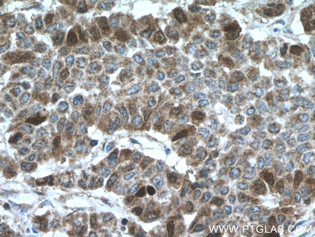 Thymidylate synthase Antibody in Immunohistochemistry (Paraffin) (IHC (P))