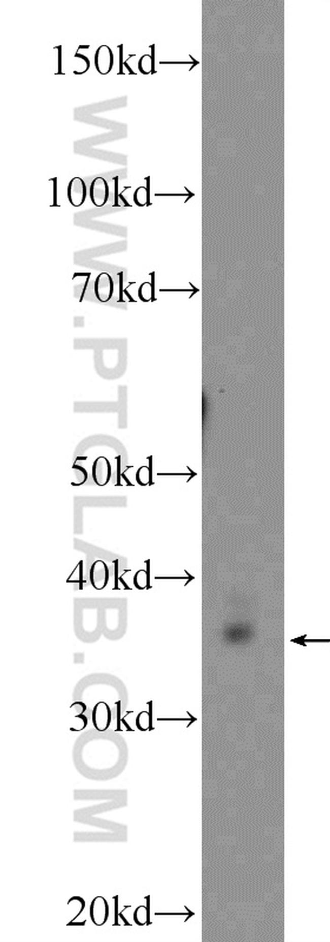 Thymidylate synthase Antibody in Western Blot (WB)