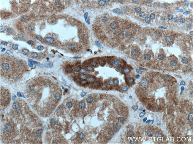 NAGK Antibody in Immunohistochemistry (Paraffin) (IHC (P))